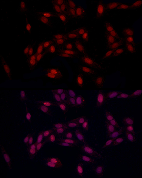 SUPT16H (SPT16) Rabbit polyclonal antibody