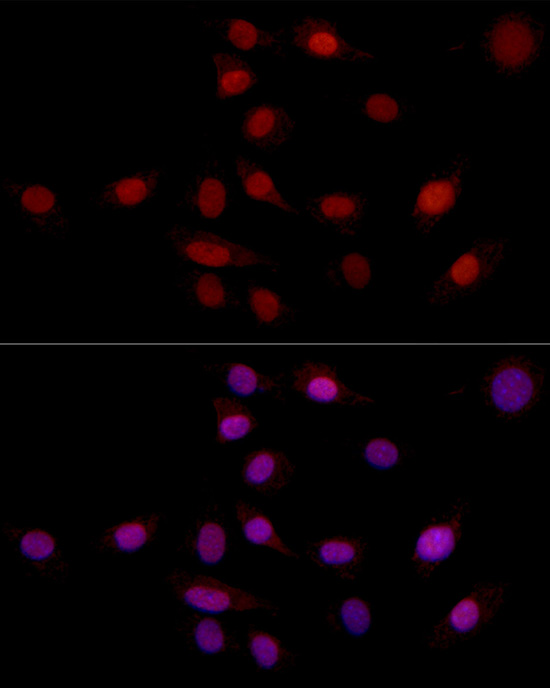 SUPT16H (SPT16) Rabbit polyclonal antibody