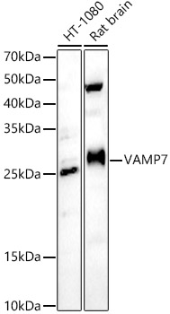 VAMP7 Rabbit polyclonal antibody