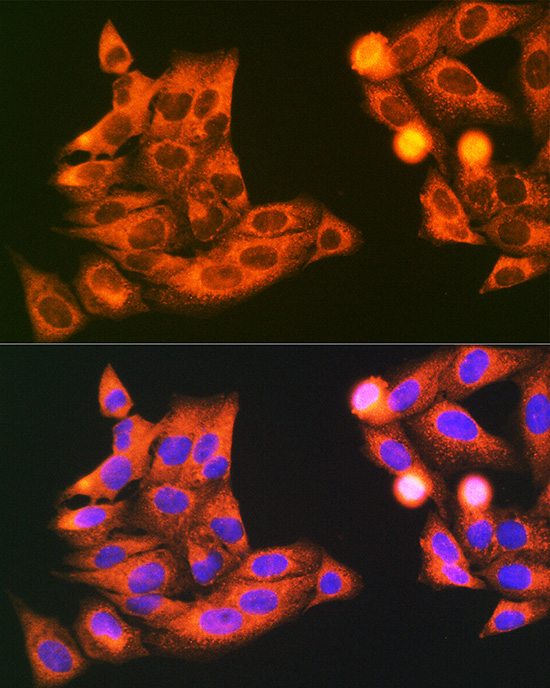 VAMP7 Rabbit polyclonal antibody