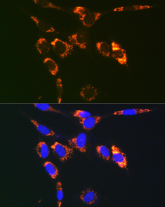 VAMP7 Rabbit polyclonal antibody