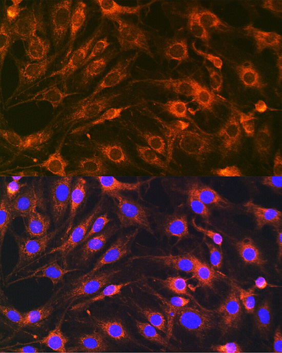 VAMP7 Rabbit polyclonal antibody