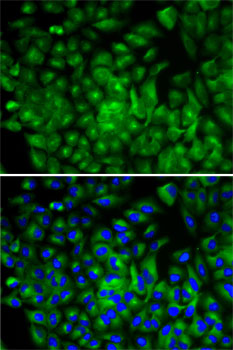 ATG16L1 Rabbit polyclonal antibody