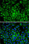 Immunofluorescence - ATG16L1 Rabbit pAb (A1871)