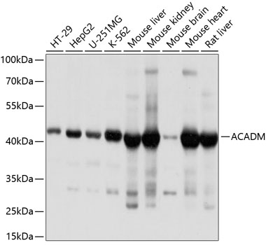 ACADM Rabbit polyclonal antibody