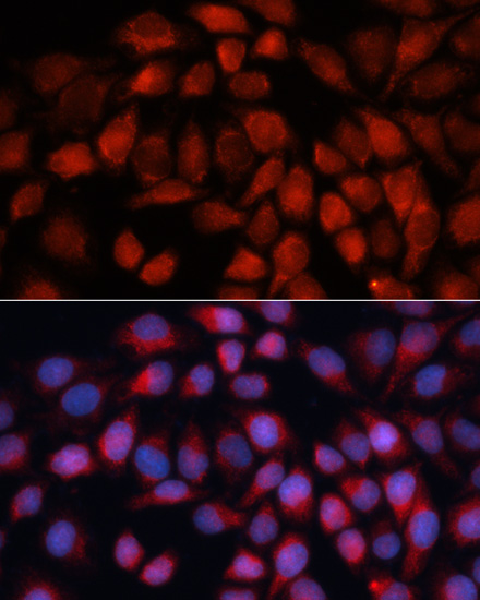 ACADM Rabbit polyclonal antibody