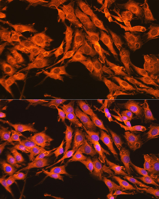 PKM2-specific Rabbit polyclonal antibody