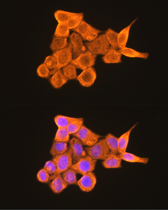 PKM2-specific Rabbit polyclonal antibody