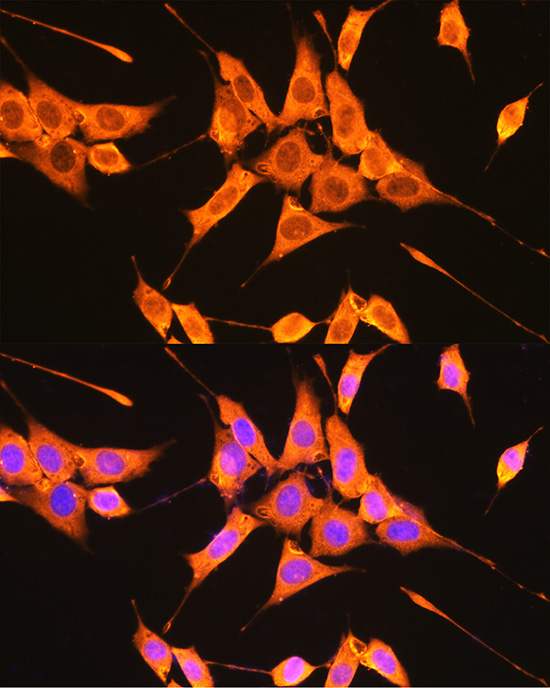 PKM2-specific Rabbit polyclonal antibody