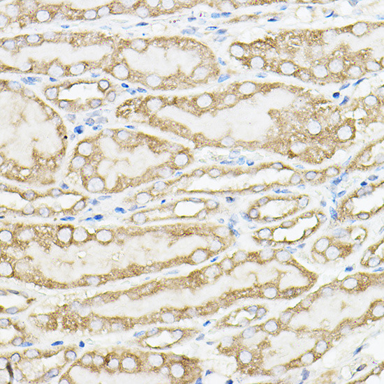 PKM1-specific Rabbit polyclonal antibody