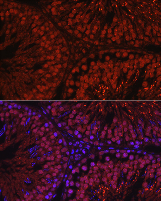 C1orf146 Rabbit polyclonal antibody