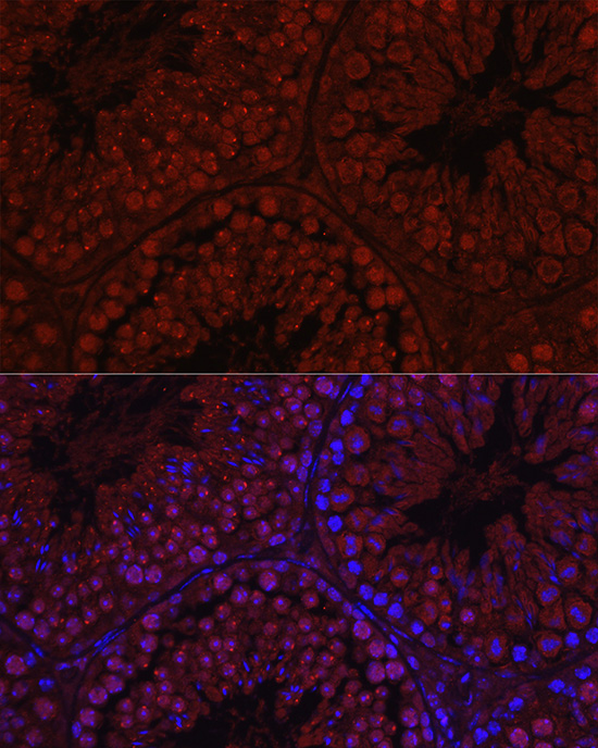 C1orf146 Rabbit polyclonal antibody
