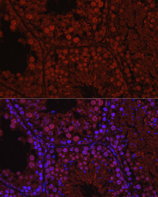 C1orf146 Rabbit polyclonal antibody