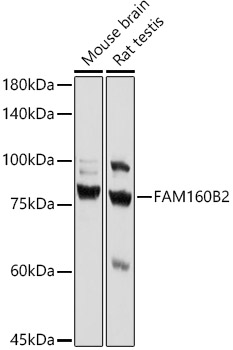 FAM160B2 Rabbit polyclonal antibody
