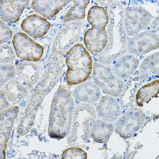 FAM160B2 Rabbit polyclonal antibody