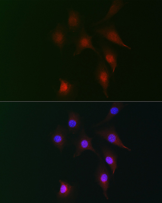FAM160B2 Rabbit polyclonal antibody