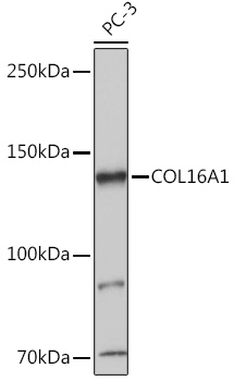 COL16A1 Rabbit polyclonal antibody