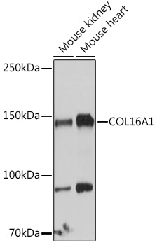COL16A1 Rabbit polyclonal antibody