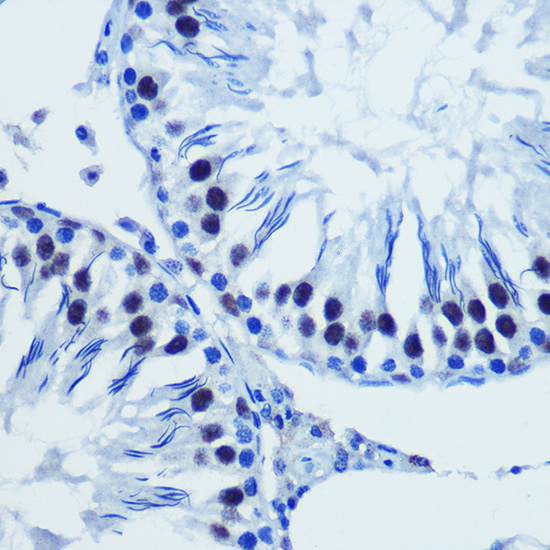 BRD4 Rabbit polyclonal antibody