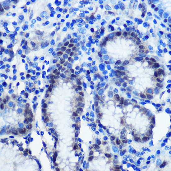BRD4 Rabbit polyclonal antibody