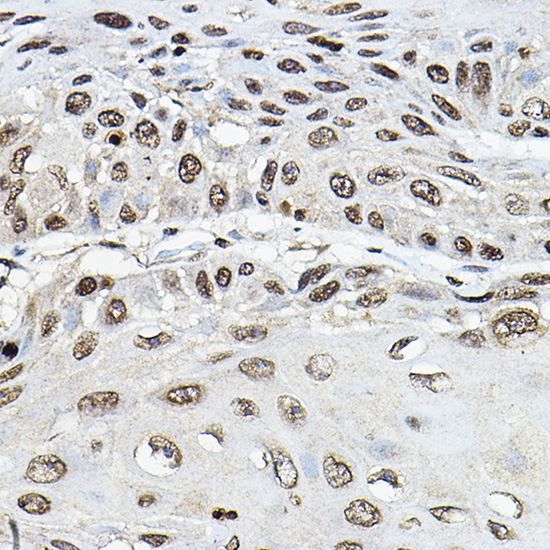 TRRAP Rabbit polyclonal antibody