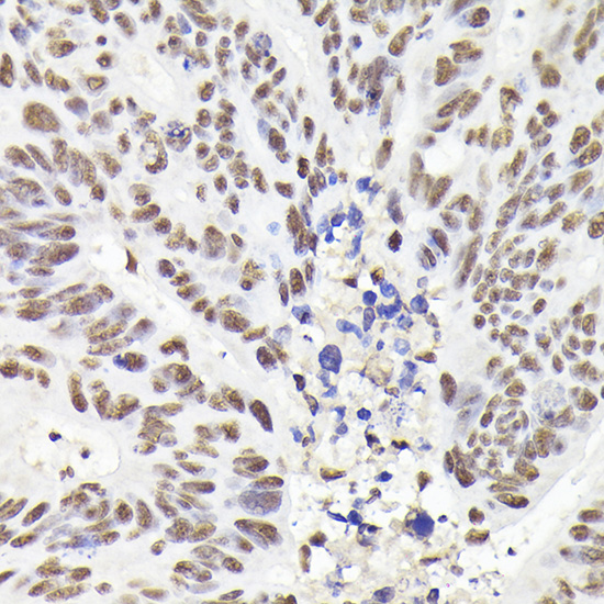 Rad21 Rabbit polyclonal antibody