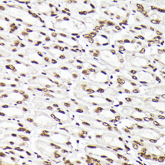 Rad21 Rabbit polyclonal antibody