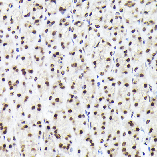 Rad21 Rabbit polyclonal antibody