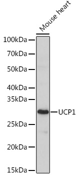 UCP1 Rabbit polyclonal antibody