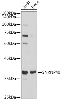 SNRNP40 Rabbit polyclonal antibody