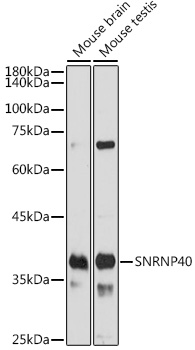 SNRNP40 Rabbit polyclonal antibody