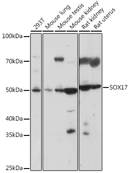 SOX17 Rabbit polyclonal antibody