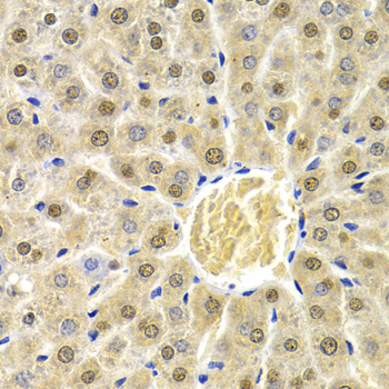 RAD9A Rabbit polyclonal antibody