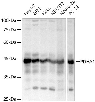 PDHA1 Rabbit polyclonal antibody