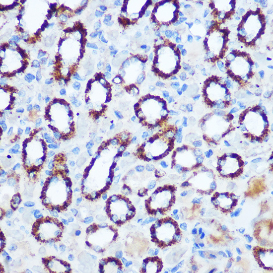 PDHA1 Rabbit polyclonal antibody
