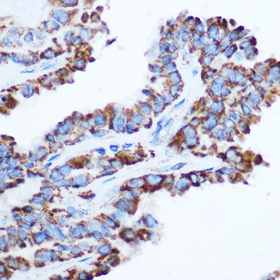 PDHA1 Rabbit polyclonal antibody