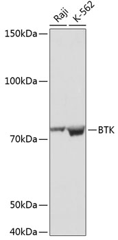 BTK Rabbit monoclonal antibody