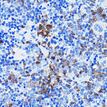 BTK Rabbit monoclonal antibody