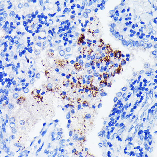 BTK Rabbit monoclonal antibody
