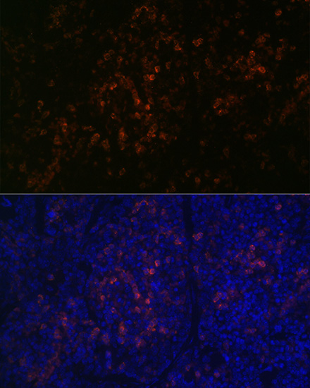 BTK Rabbit monoclonal antibody