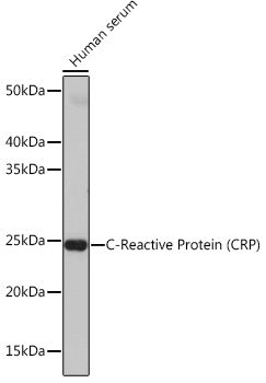 C-Reactive Protein (CRP) Rabbit monoclonal antibody