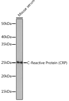 C-Reactive Protein (CRP) Rabbit monoclonal antibody