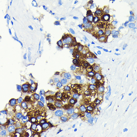 C-Reactive Protein (CRP) Rabbit monoclonal antibody