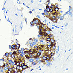 Western blot - C-Reactive Protein (CRP) Rabbit mAb (A19003)