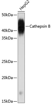 Cathepsin B Rabbit monoclonal antibody