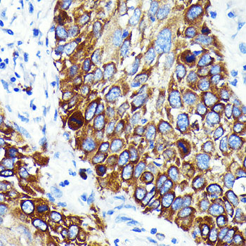 Cathepsin B Rabbit monoclonal antibody