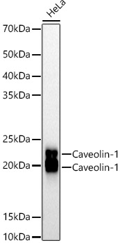 [KO Validated] Caveolin-1 Rabbit monoclonal antibody