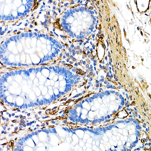 [KO Validated] Caveolin-1 Rabbit monoclonal antibody