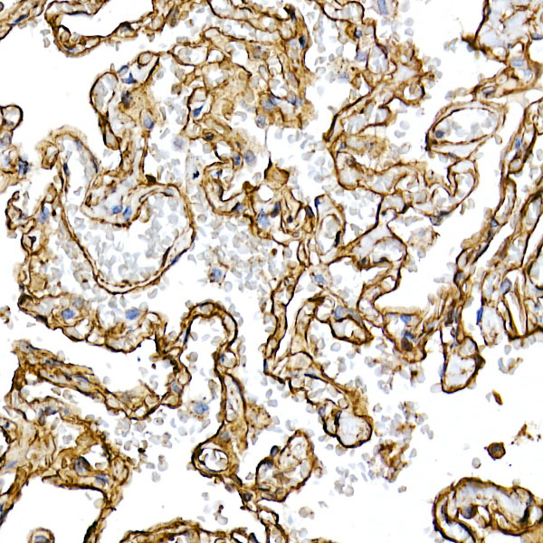 [KO Validated] Caveolin-1 Rabbit monoclonal antibody