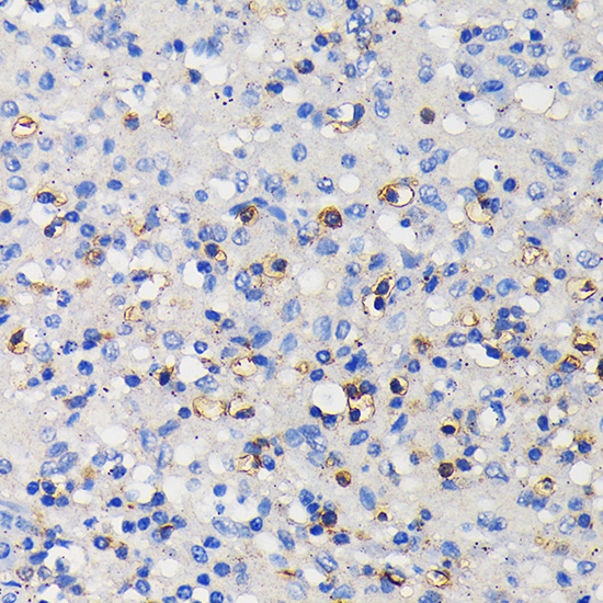 CD11a/LFA-1A/ITGAL Rabbit monoclonal antibody